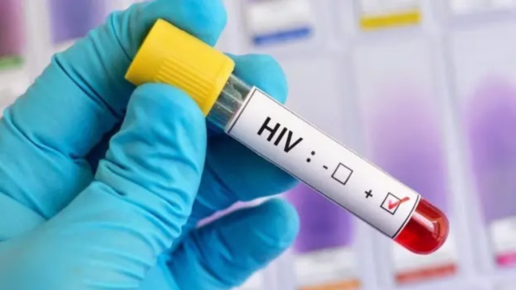 Atención médica especializada para personas que viven con VIH en Quintana Roo.