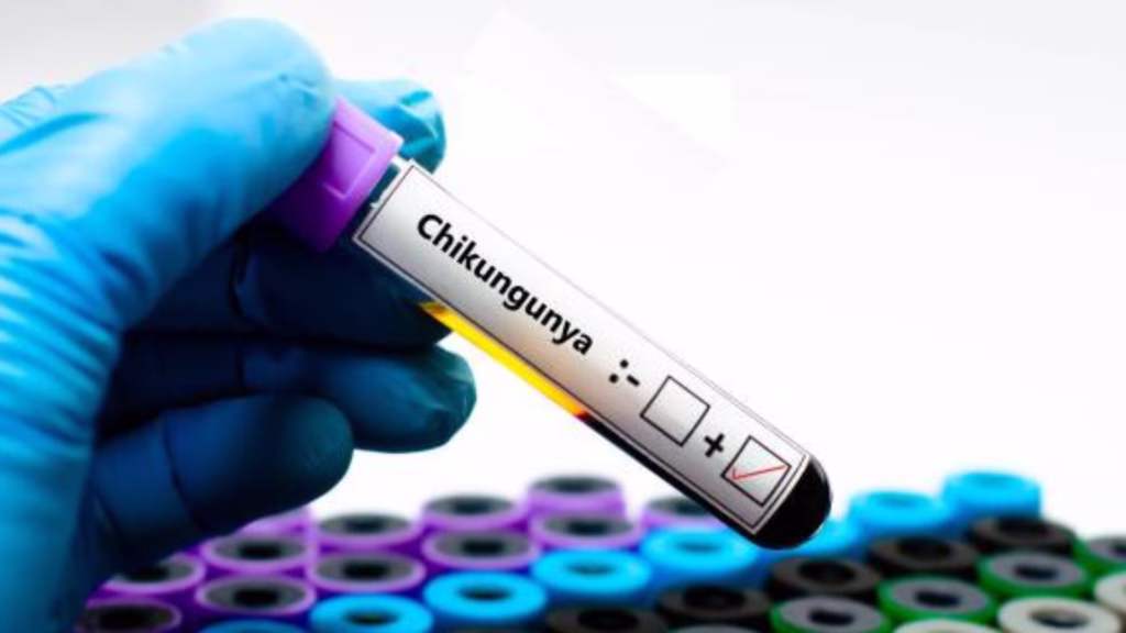 Muestra de laboratorio para diagnóstico de chikungunya como parte de la vigilancia epidemiológica en Quintana Roo.