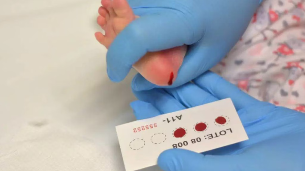 Prueba de tamiz neonatal ampliado en Quintana Roo a un recién nacido.